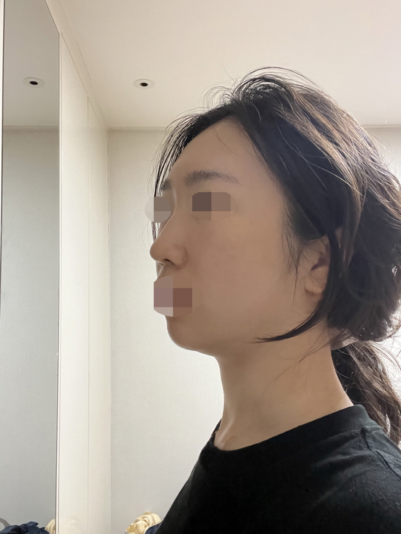 수술후기이미지