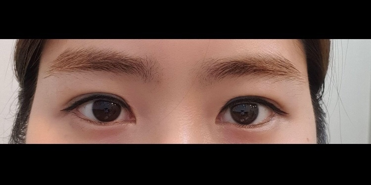 수술후기이미지