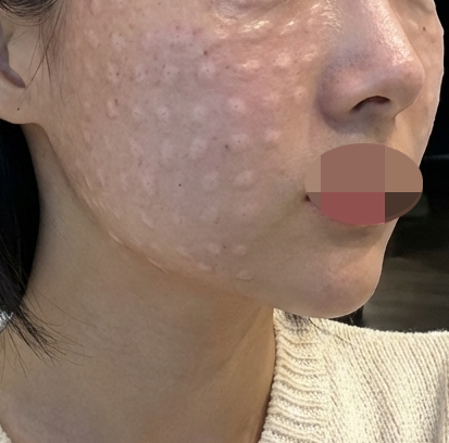 수술후기이미지