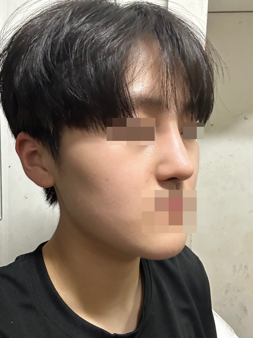 수술후기이미지