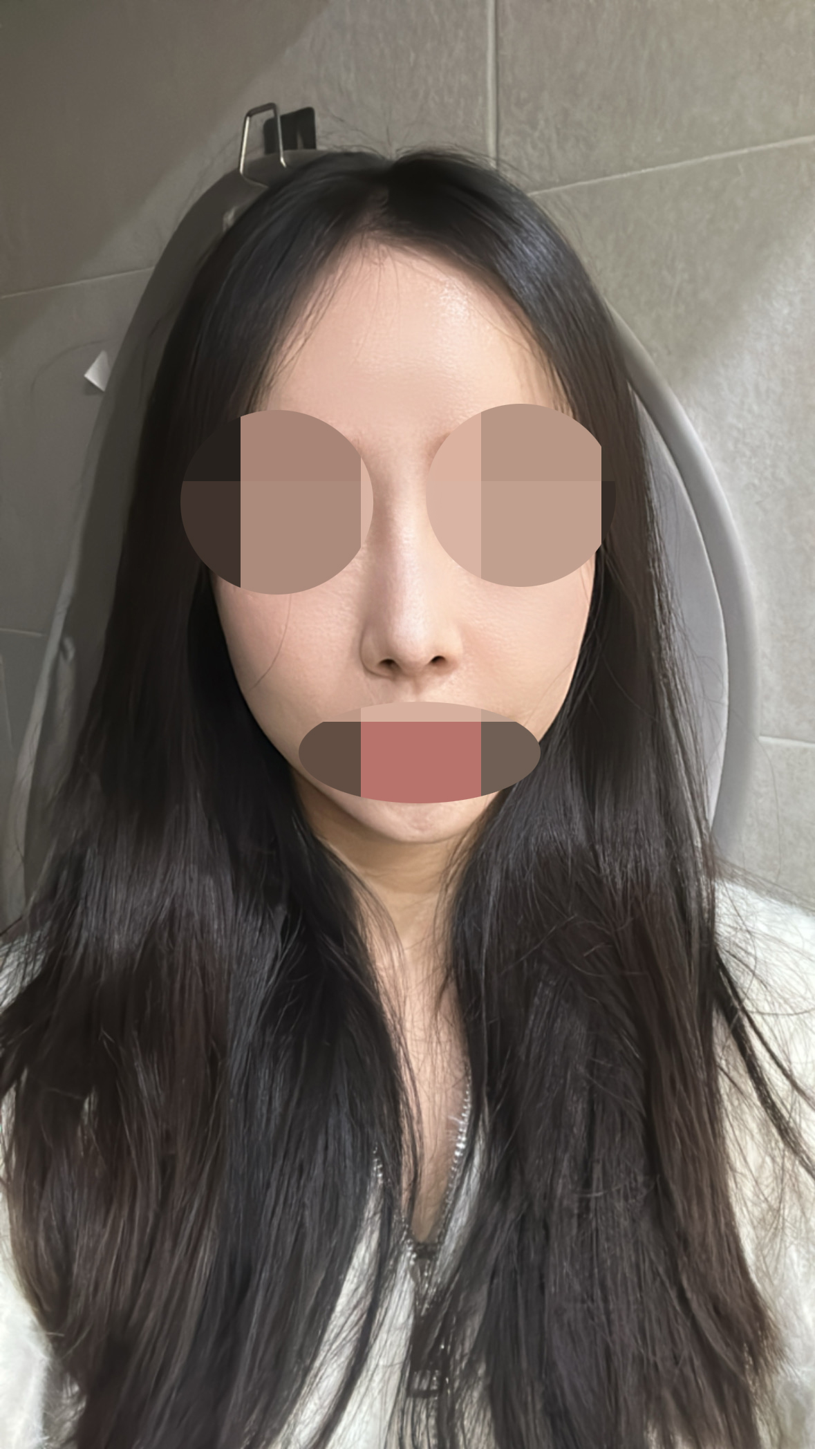 수술후기이미지