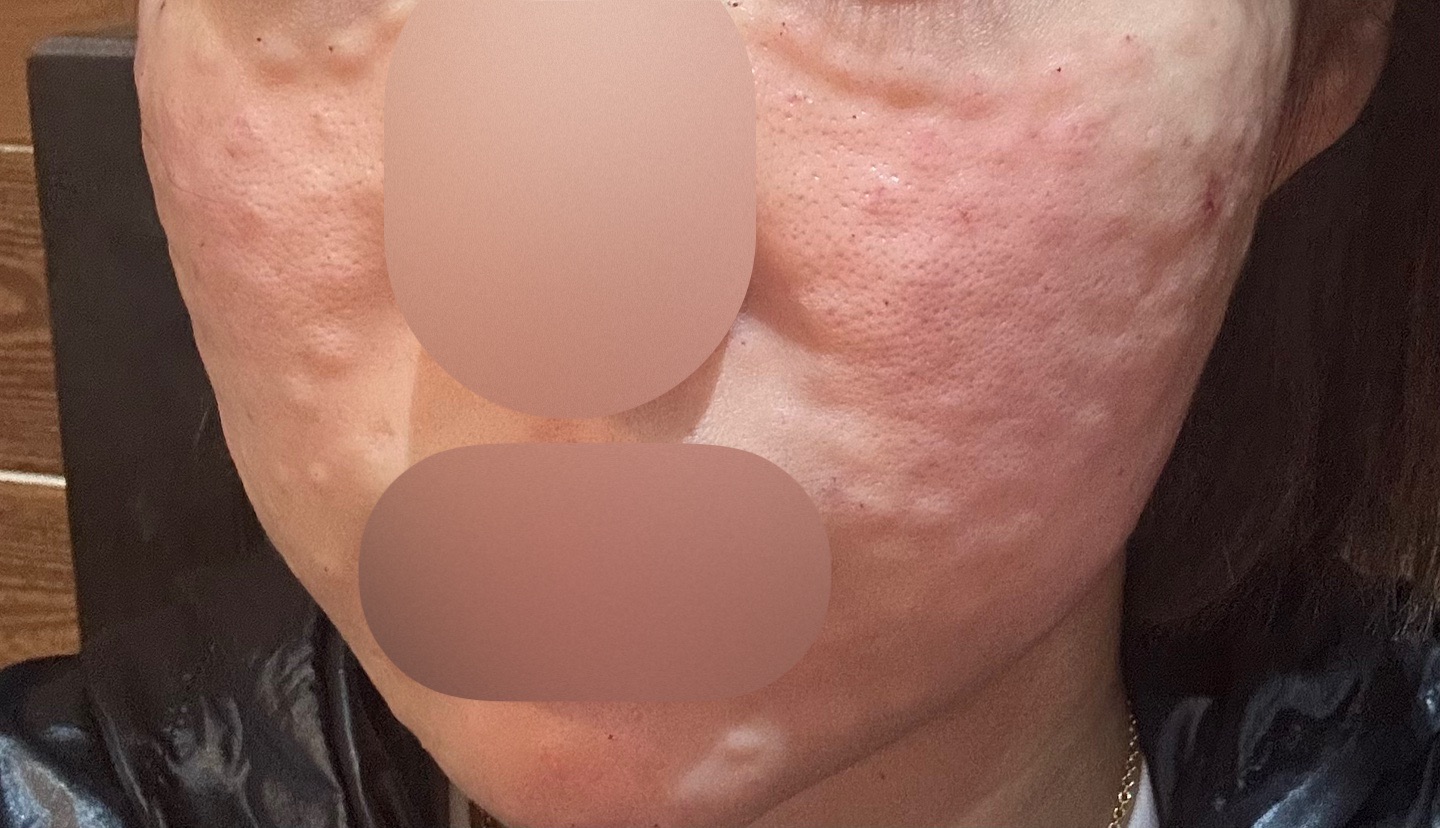 수술후기이미지