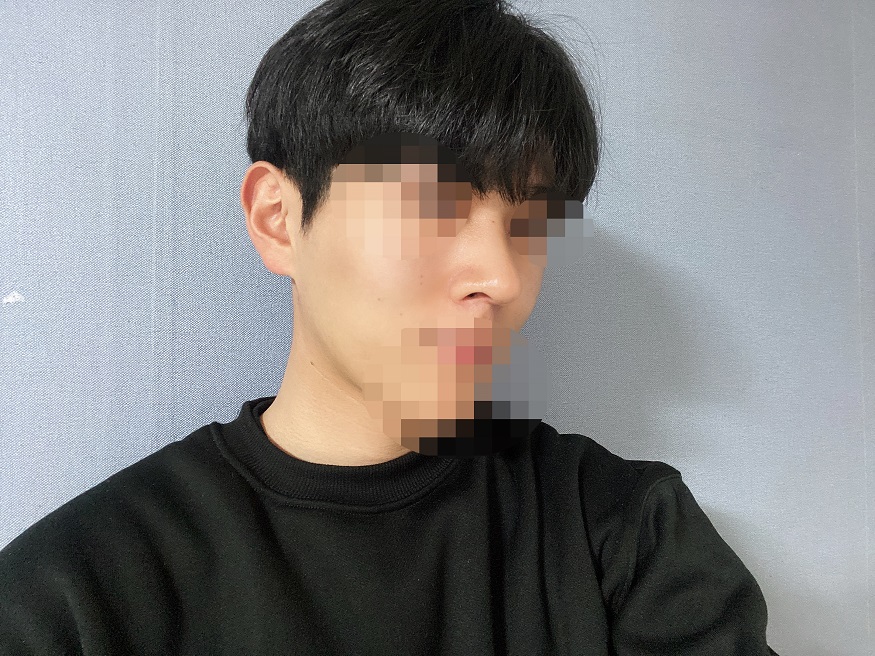 수술후기이미지