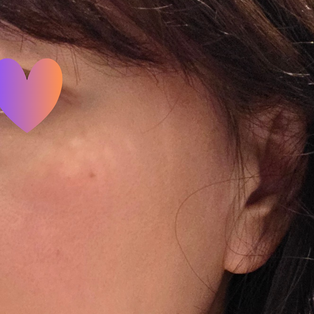 수술후기이미지