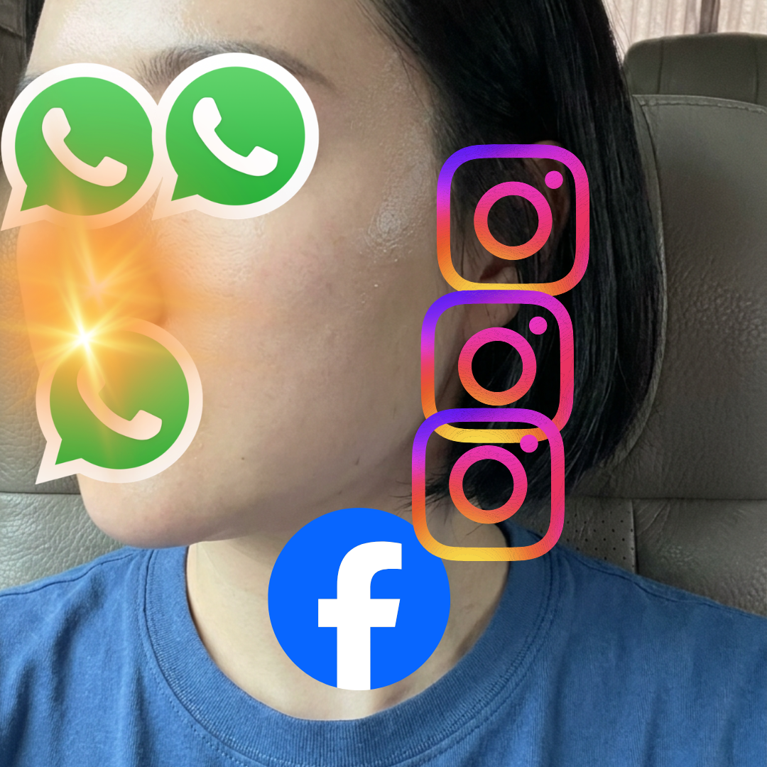 수술후기이미지