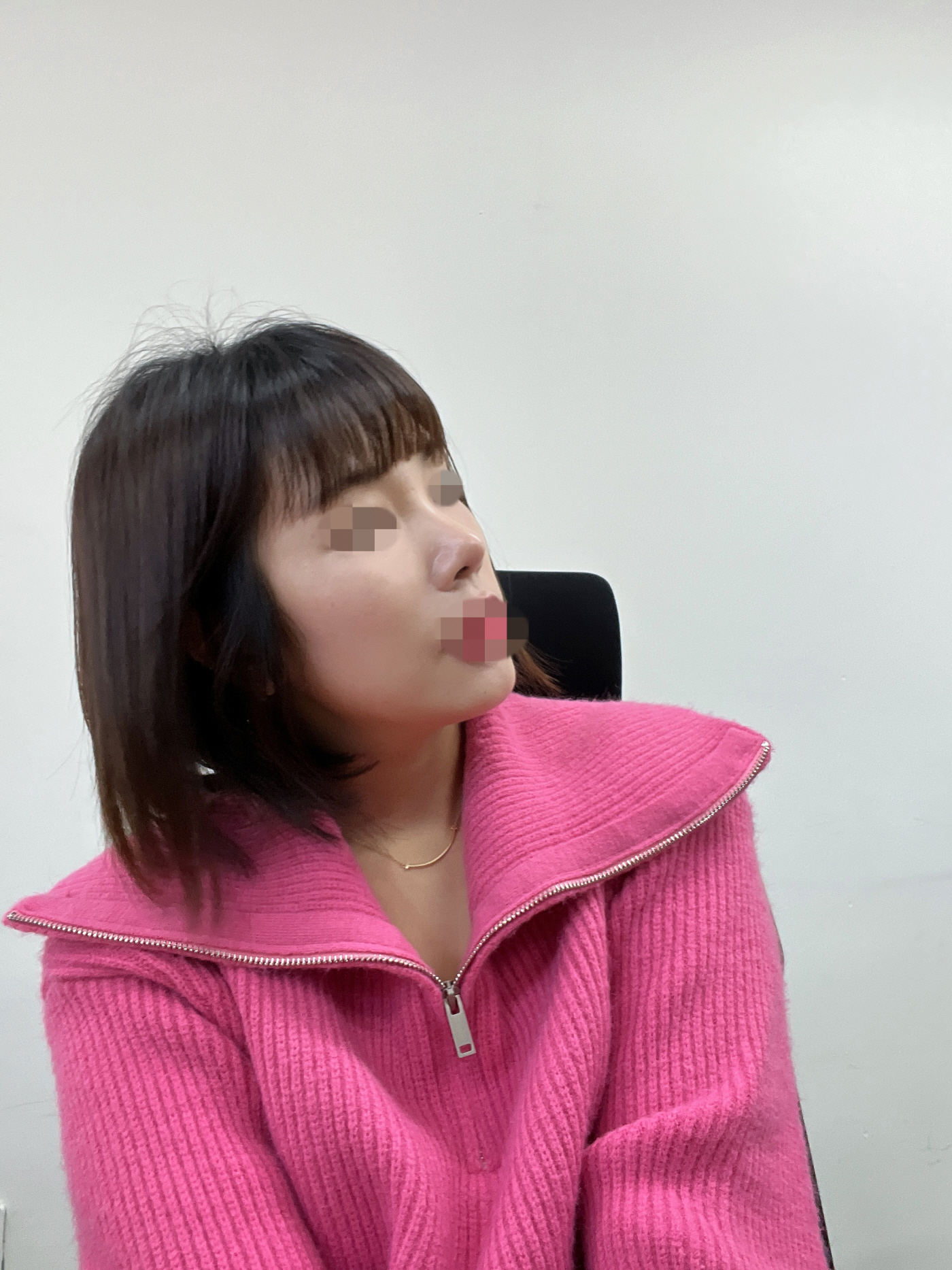 수술후기이미지