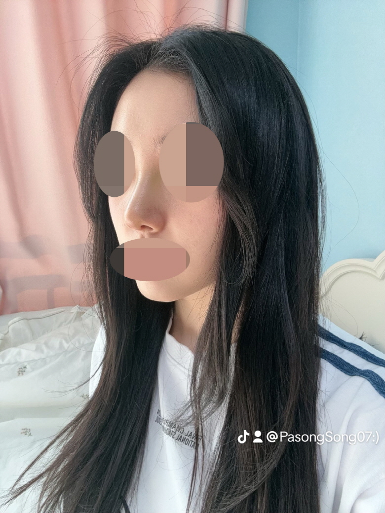 수술후기이미지