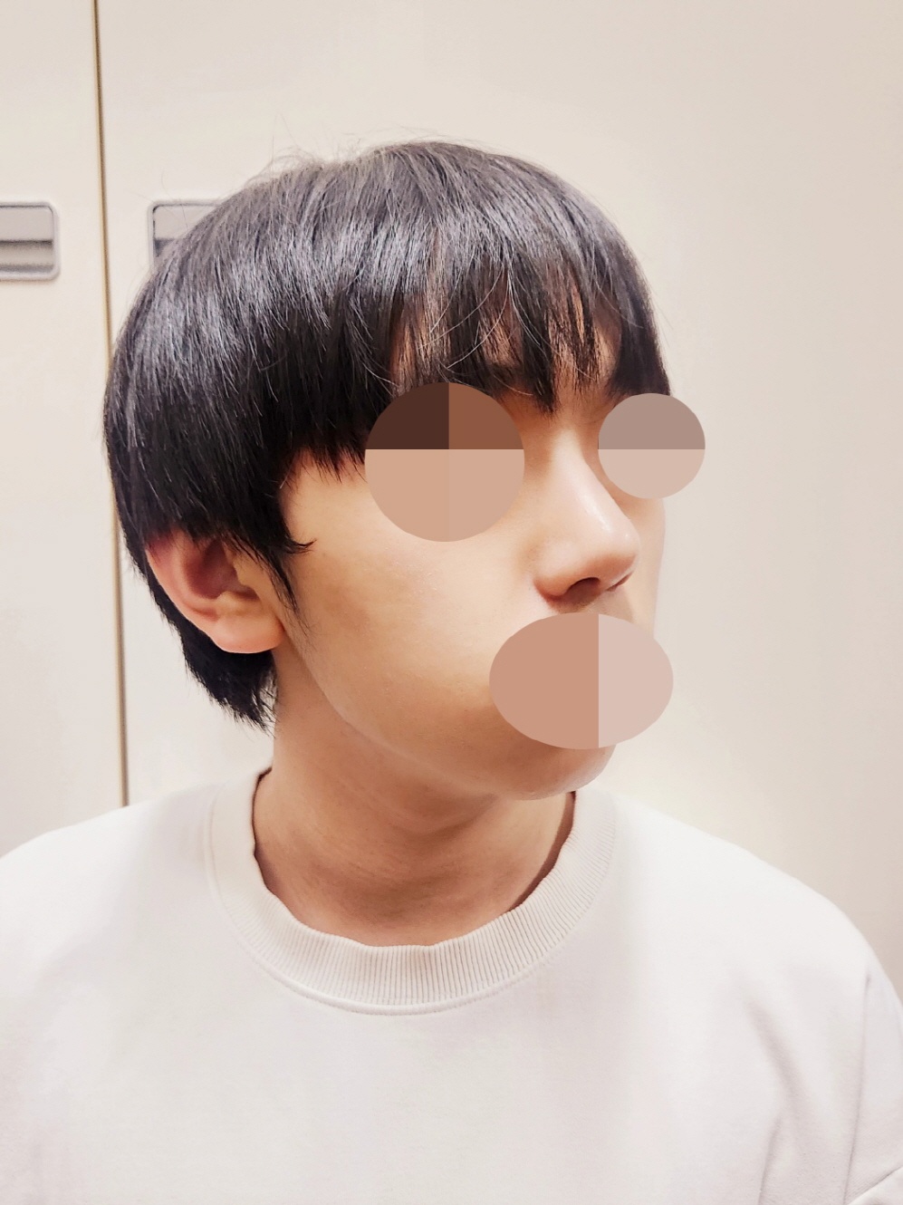 수술후기이미지