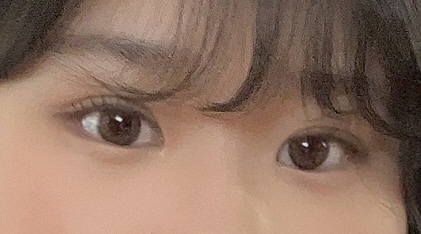 수술후기이미지