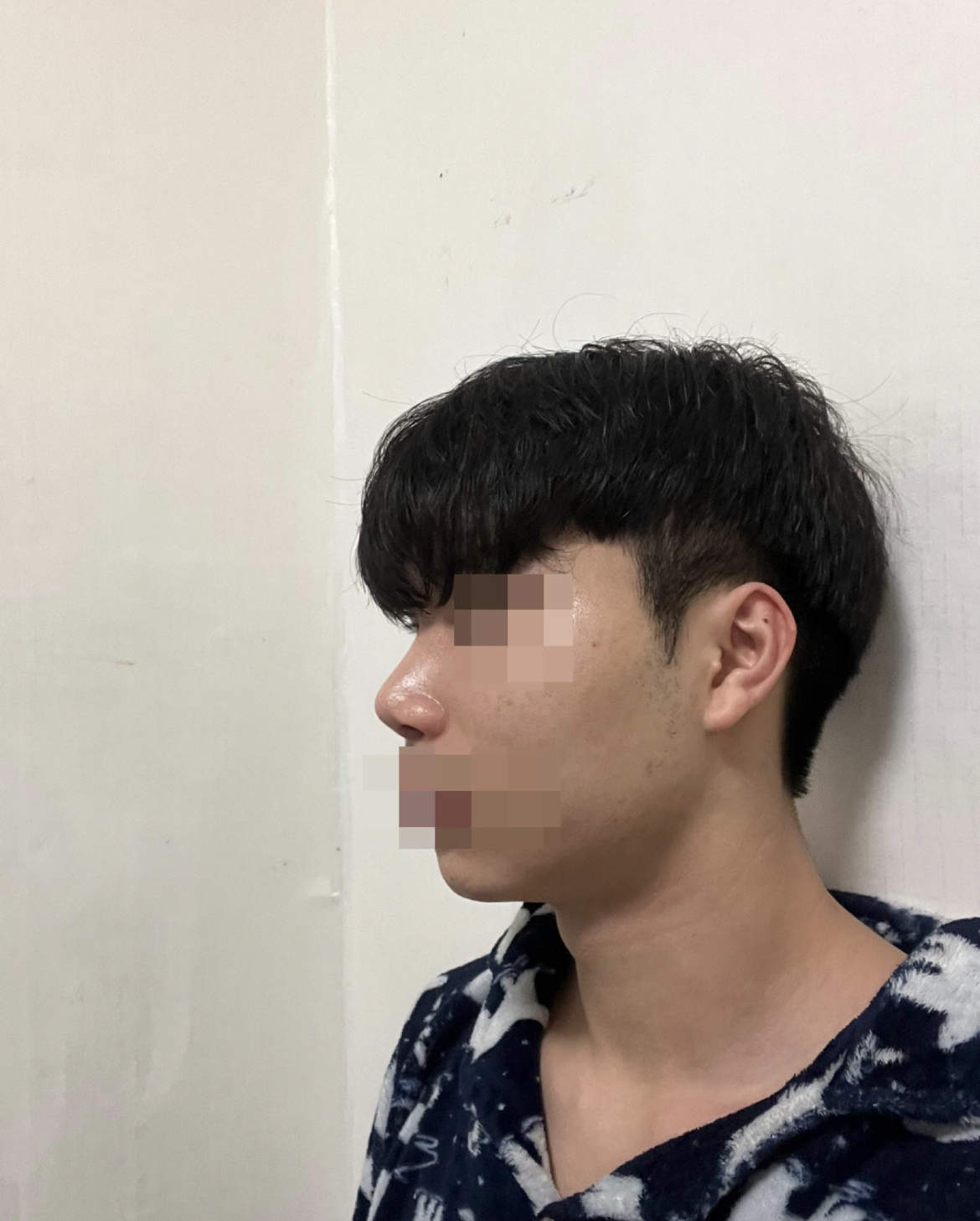 수술후기이미지