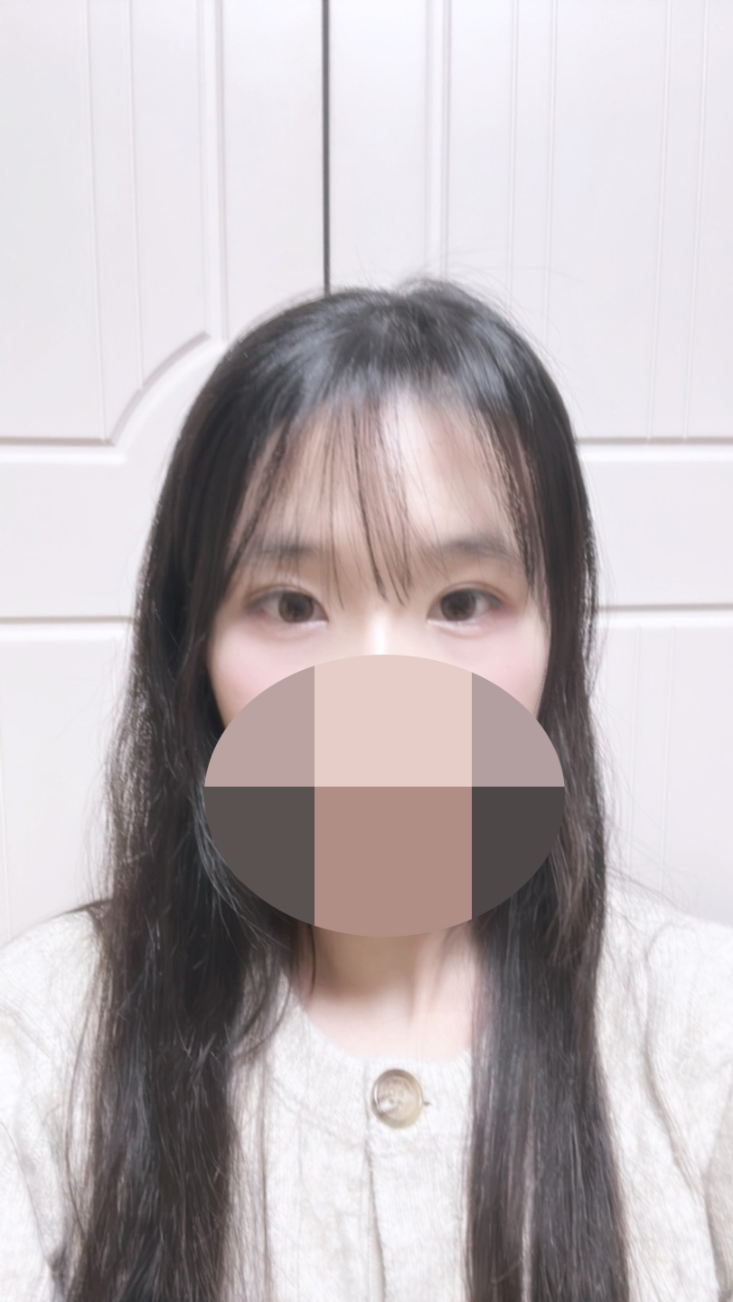 수술후기이미지