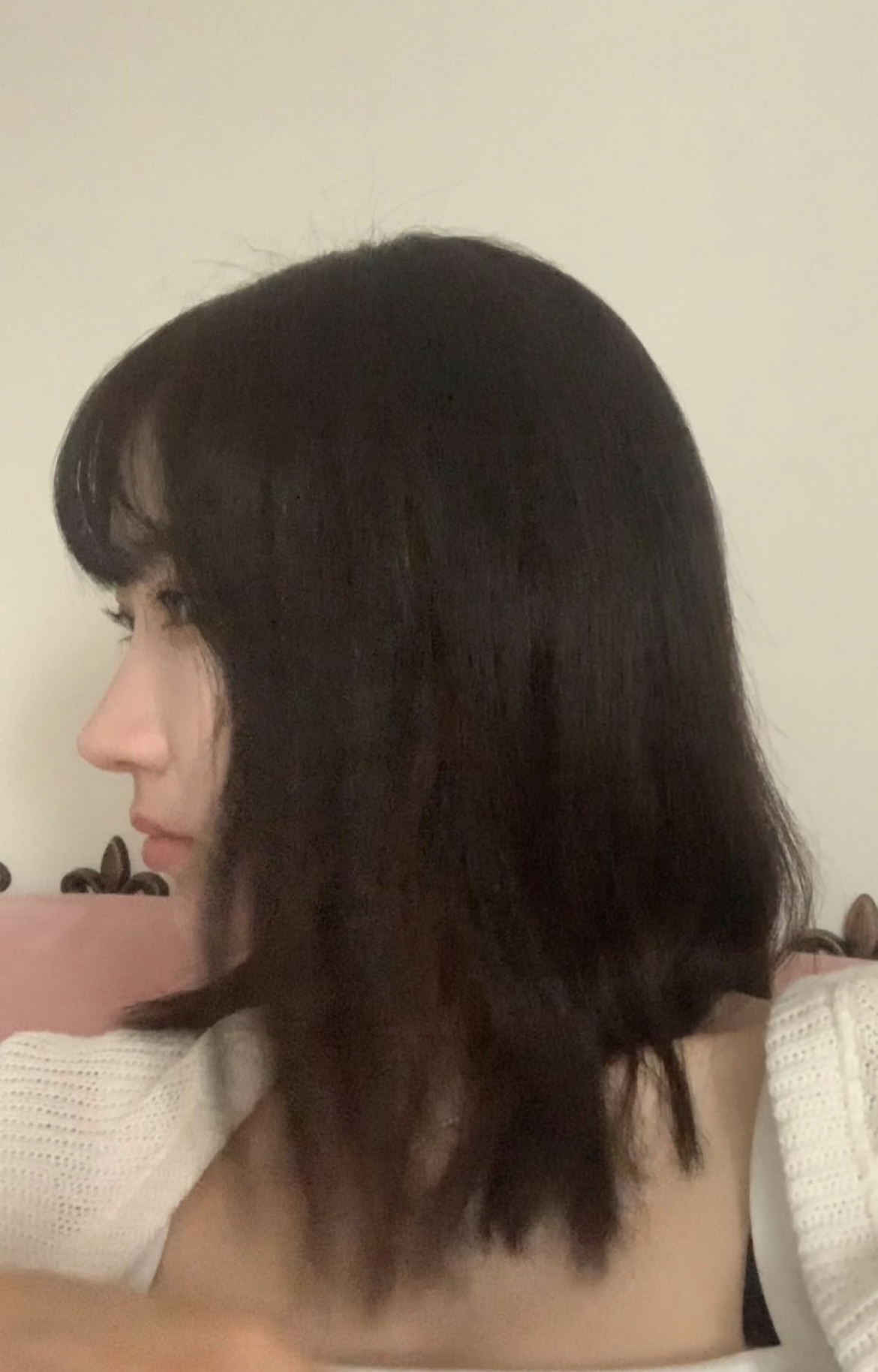 수술후기이미지