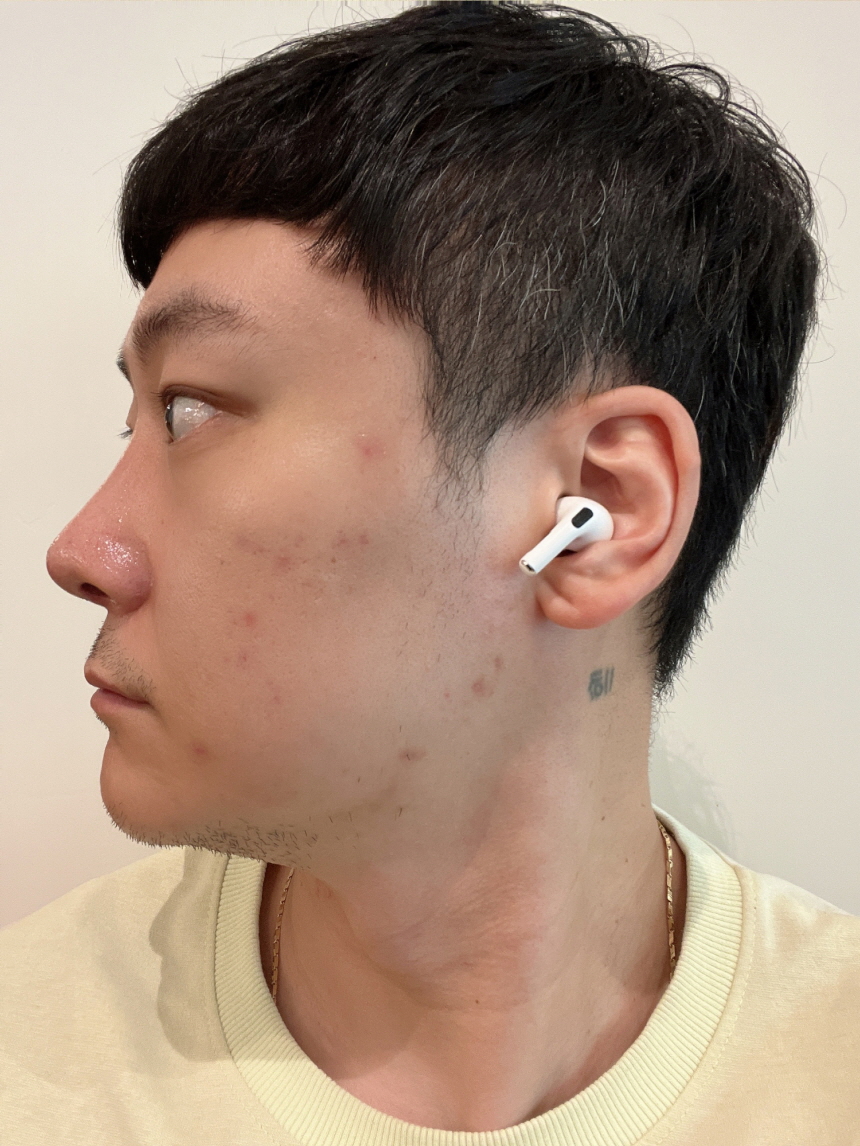 수술후기이미지