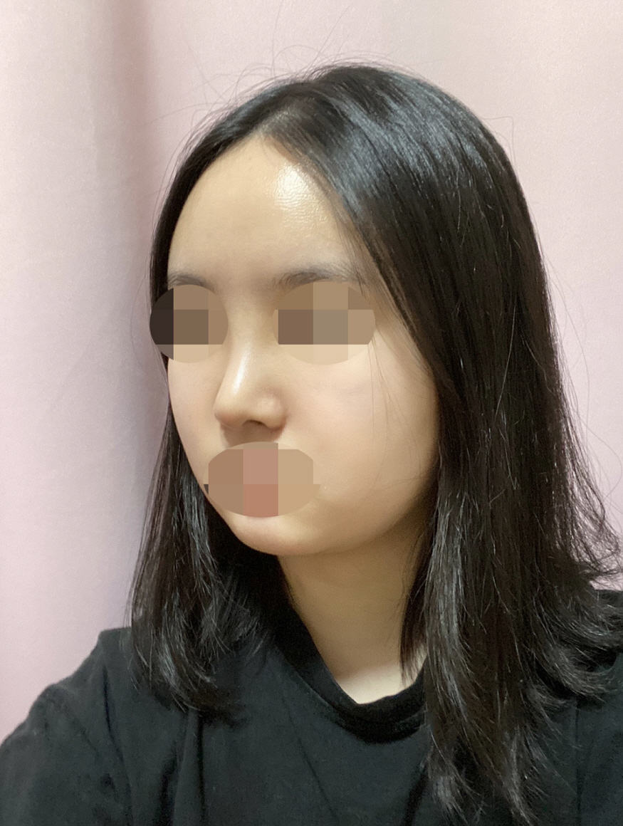 수술후기이미지