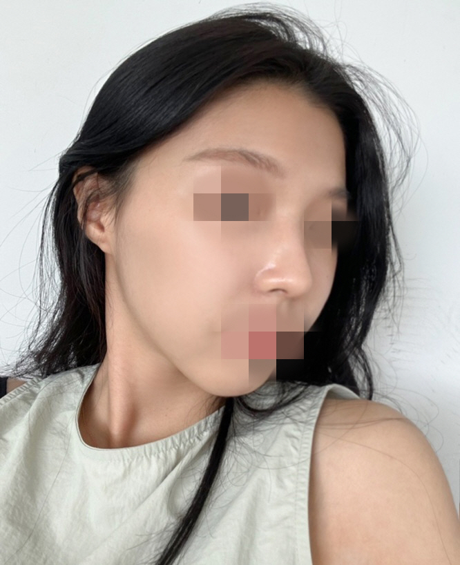 수술후기이미지