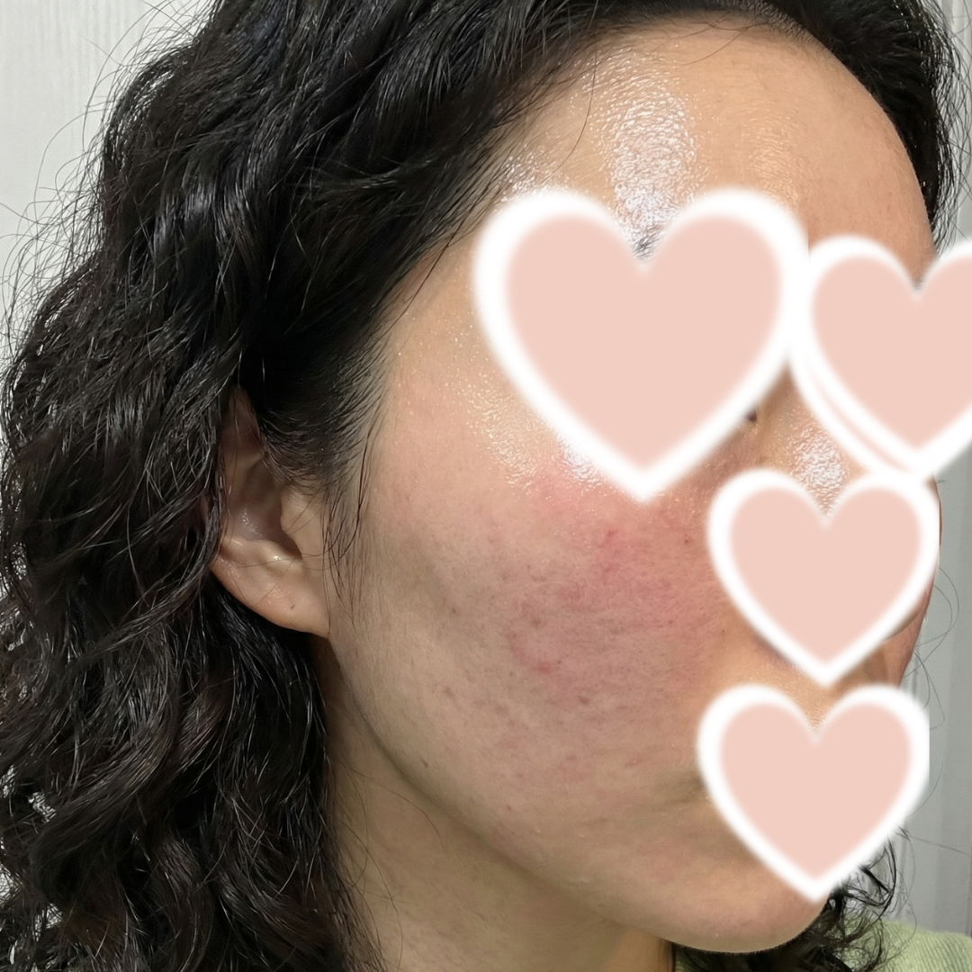 수술후기이미지