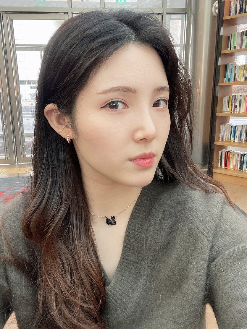 수술후기이미지