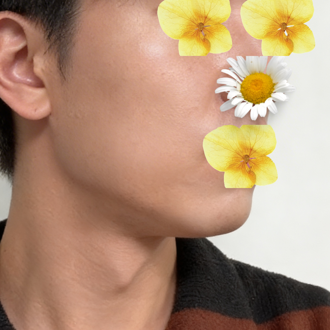 수술후기이미지