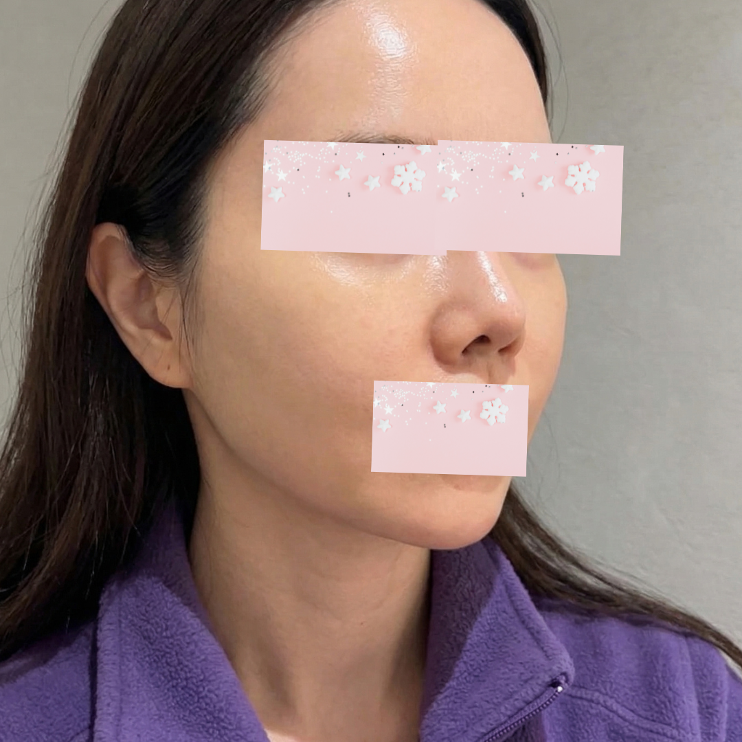 수술후기이미지