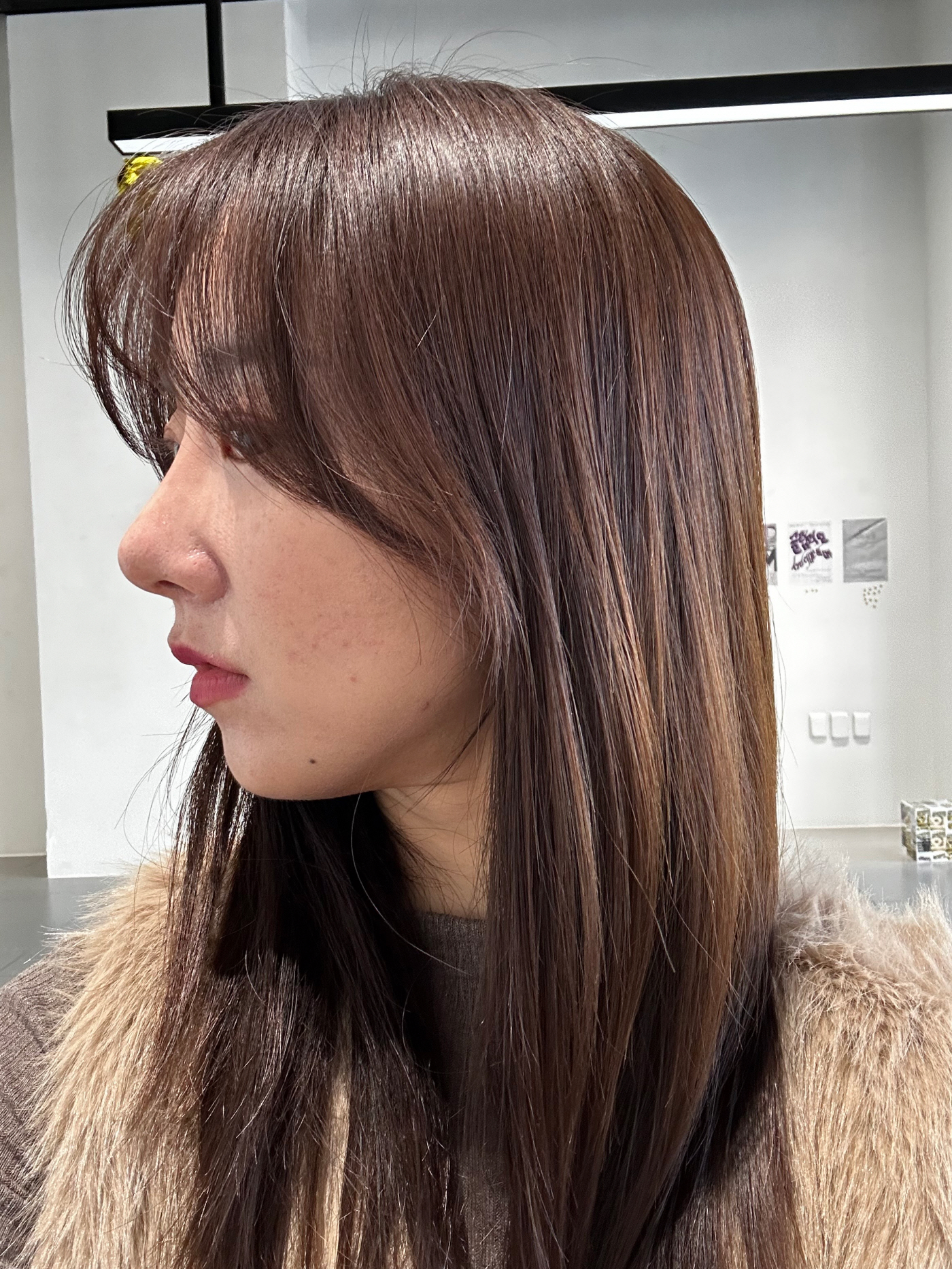 수술후기이미지