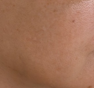 수술후기이미지