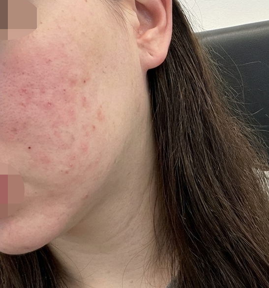 수술후기이미지