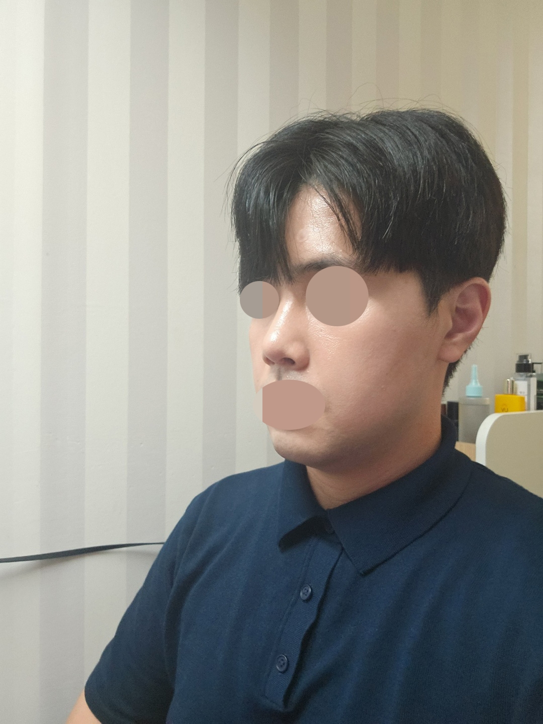 수술후기이미지