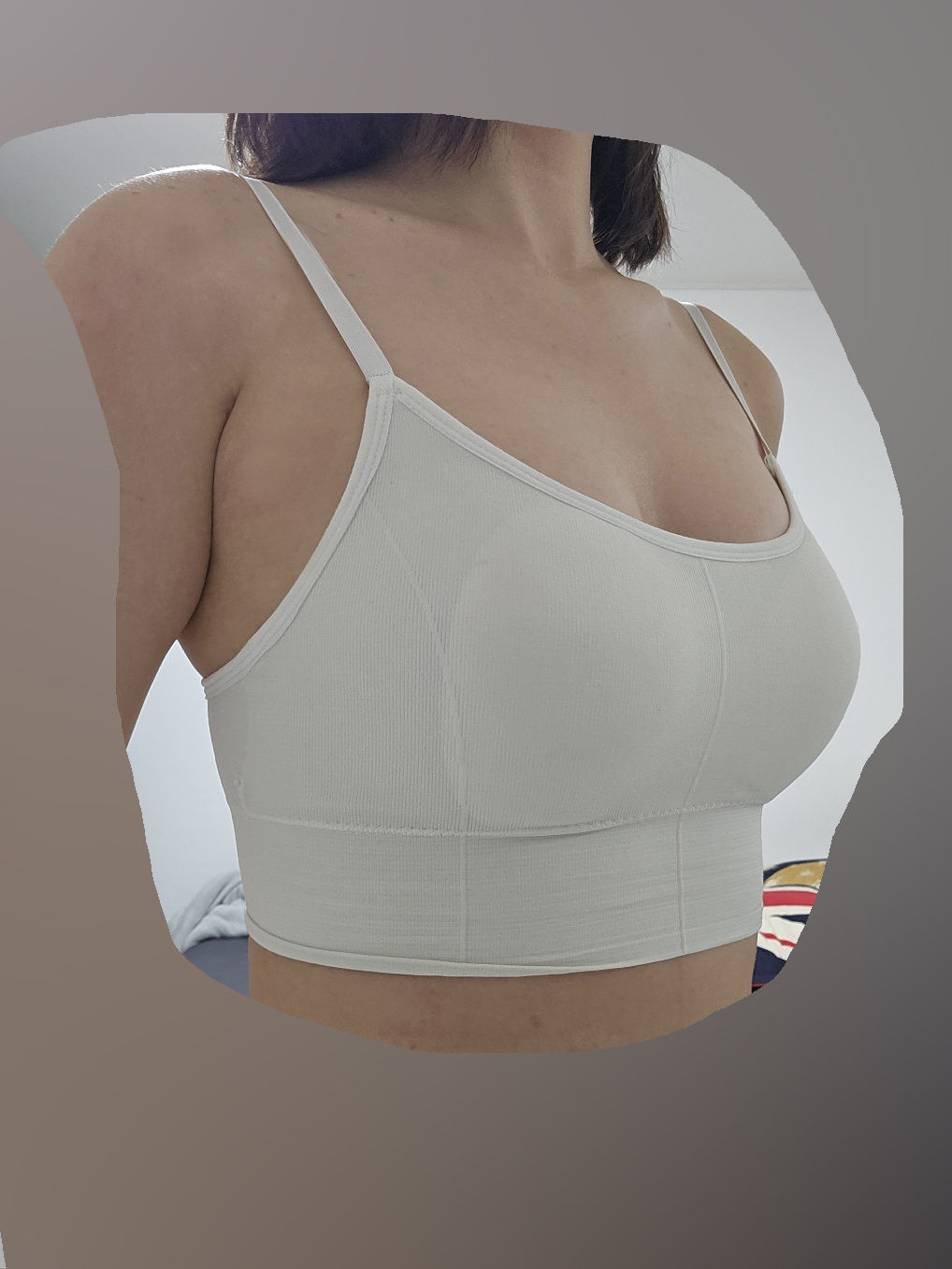 수술후기이미지