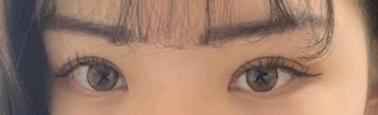 수술후기이미지