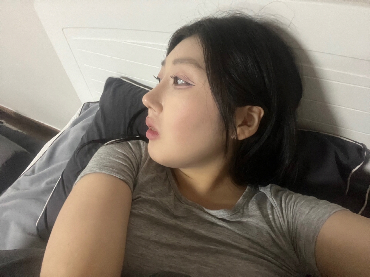 수술후기이미지