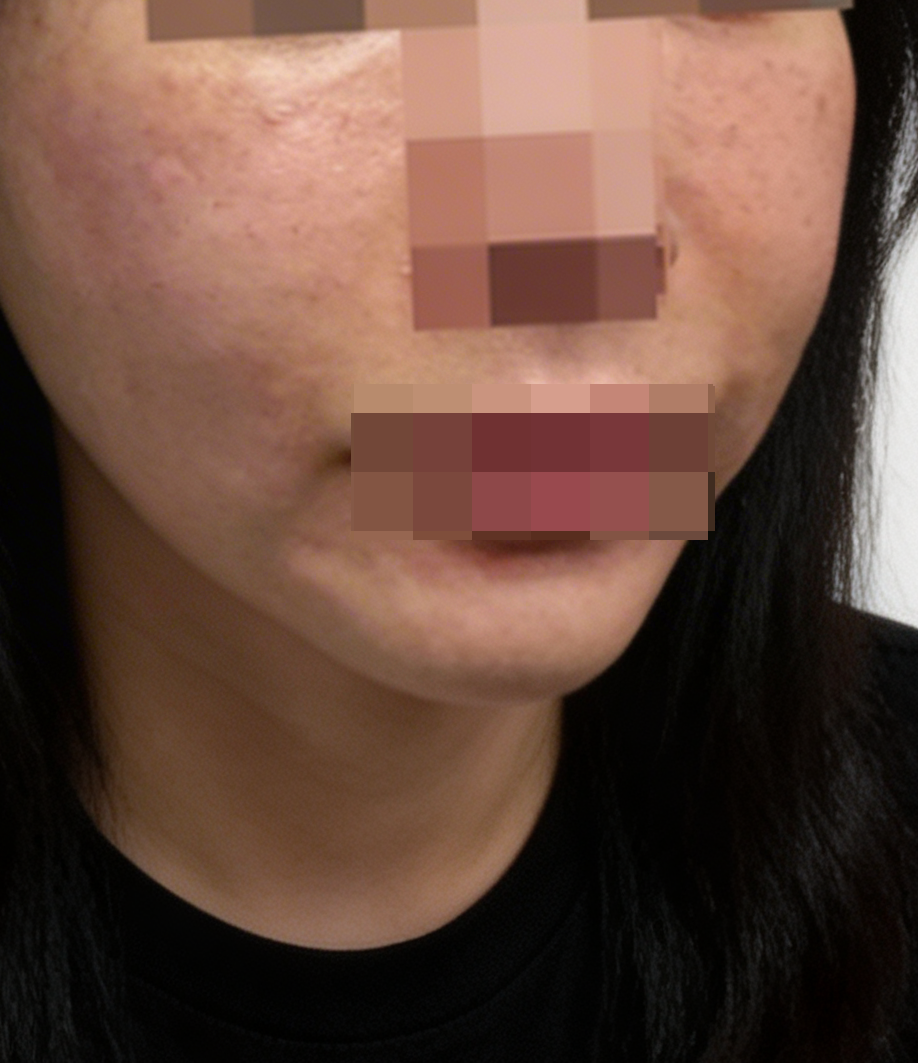 수술후기이미지