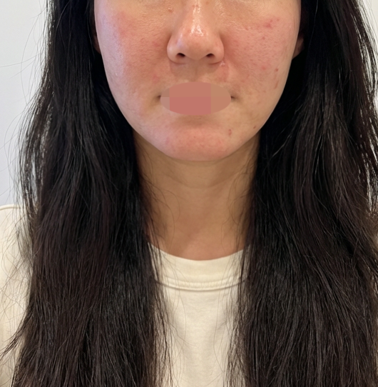 수술후기이미지