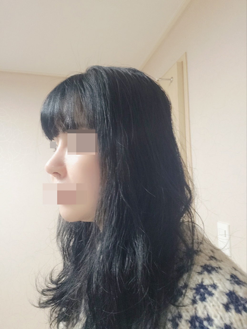 수술후기이미지