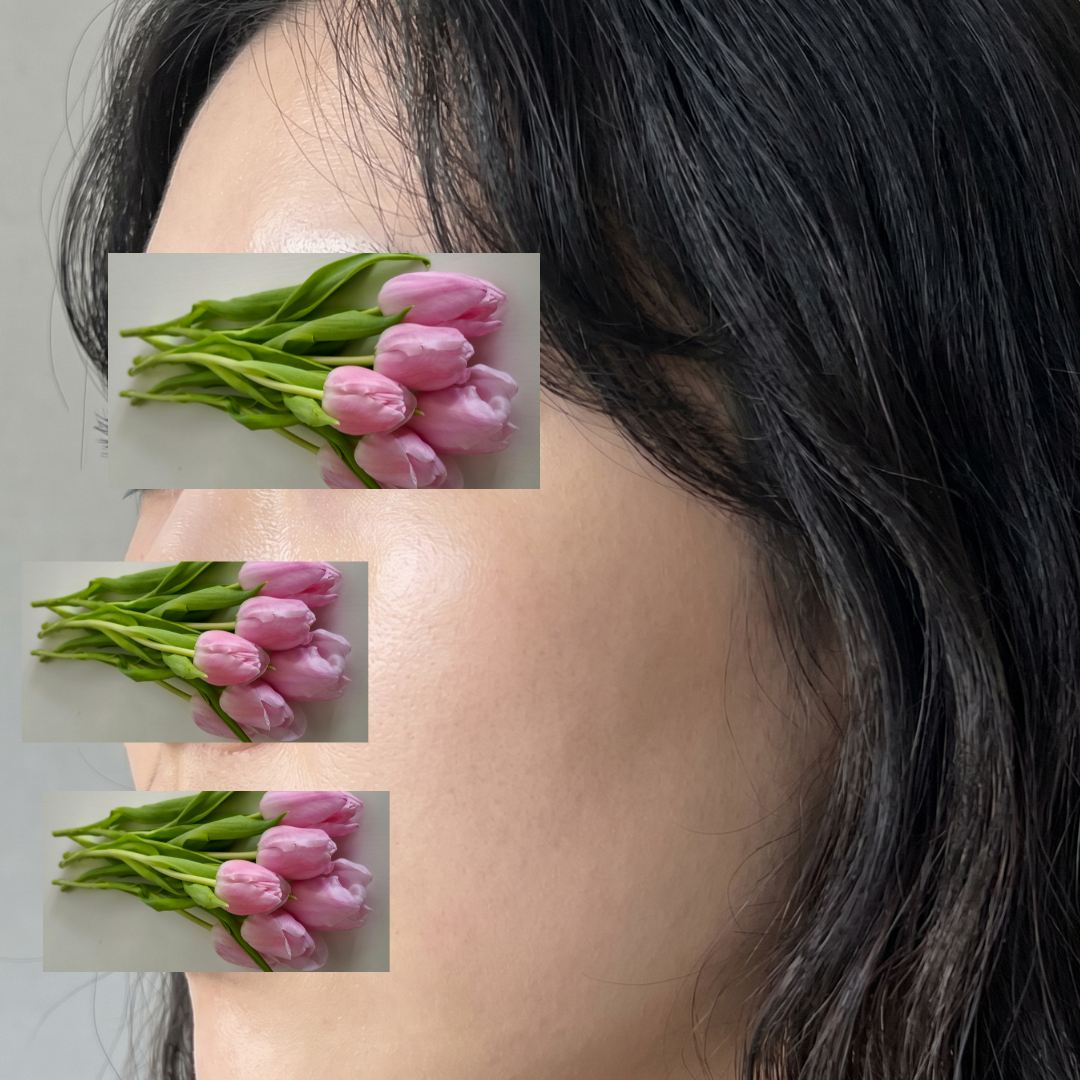 수술후기이미지