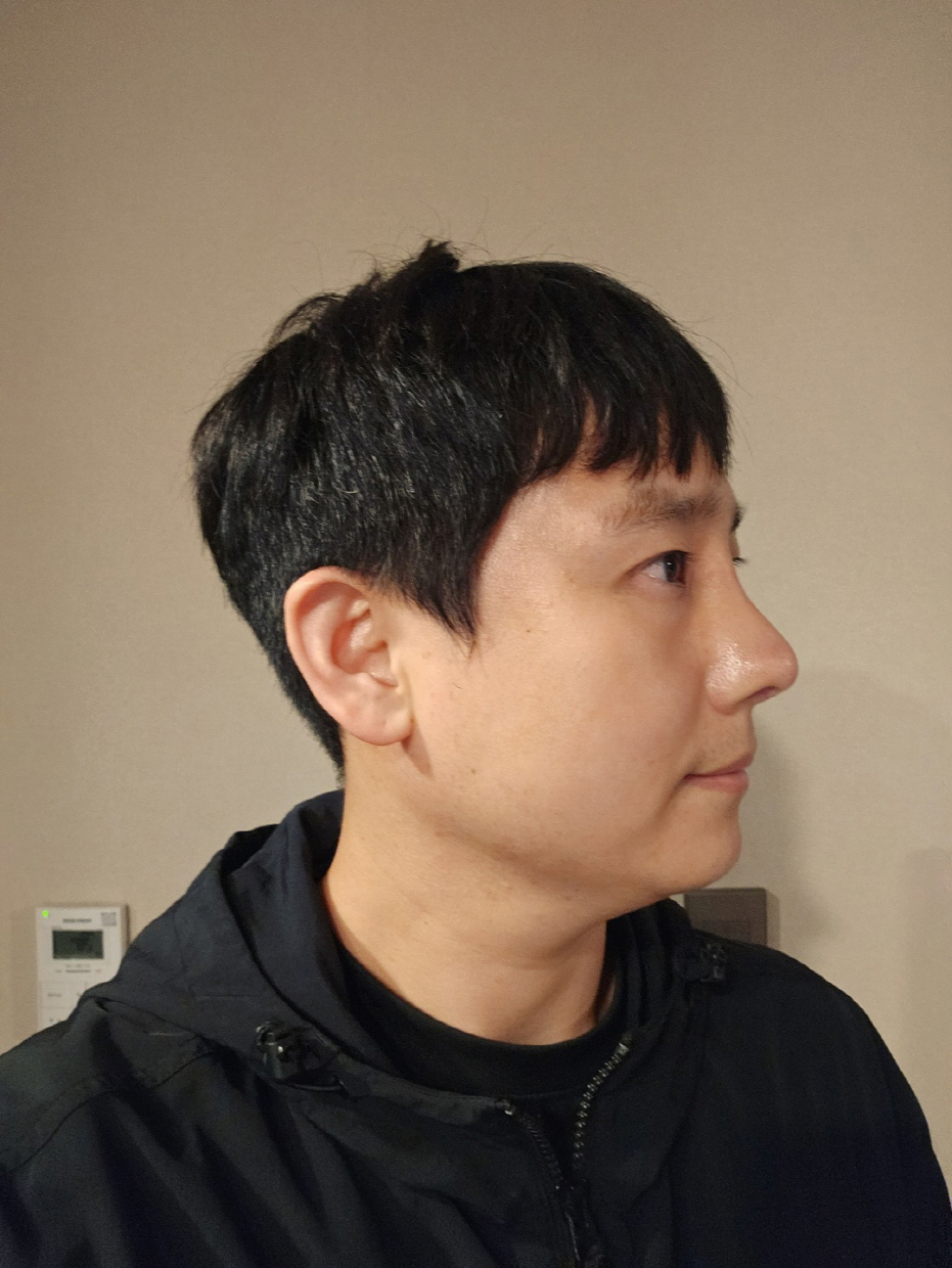 수술후기이미지