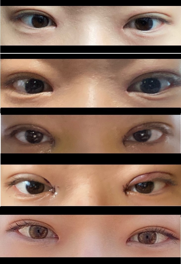 수술후기이미지