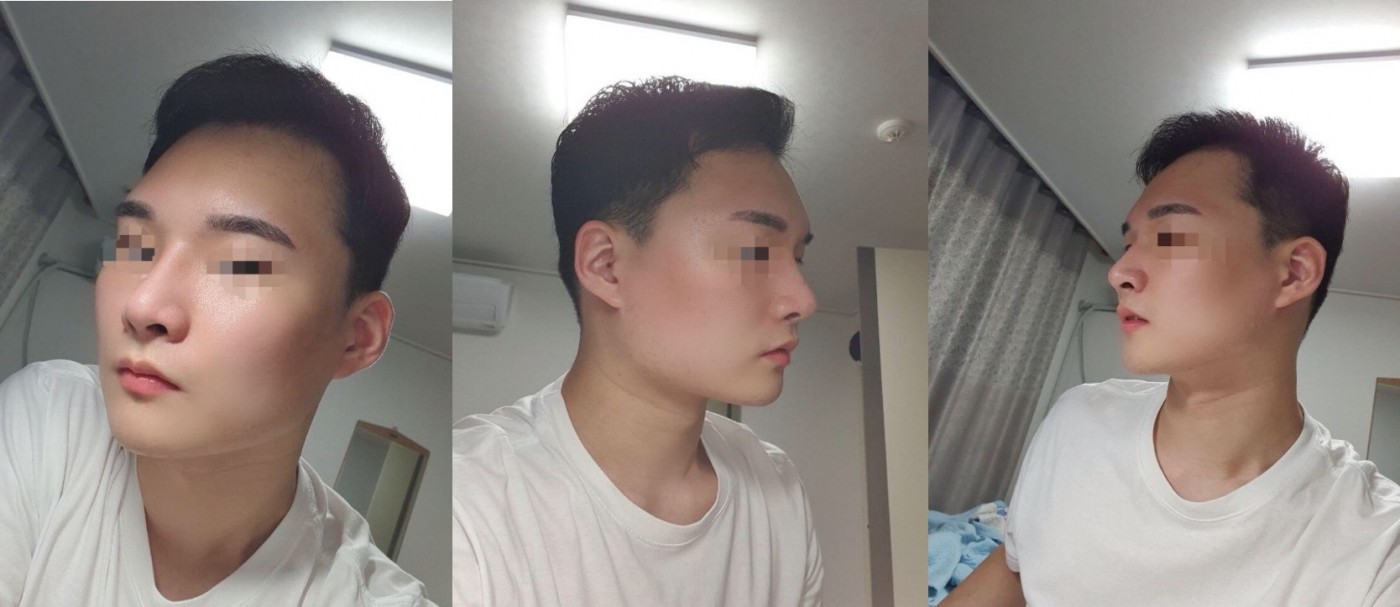 코+풀페지이 3개월차