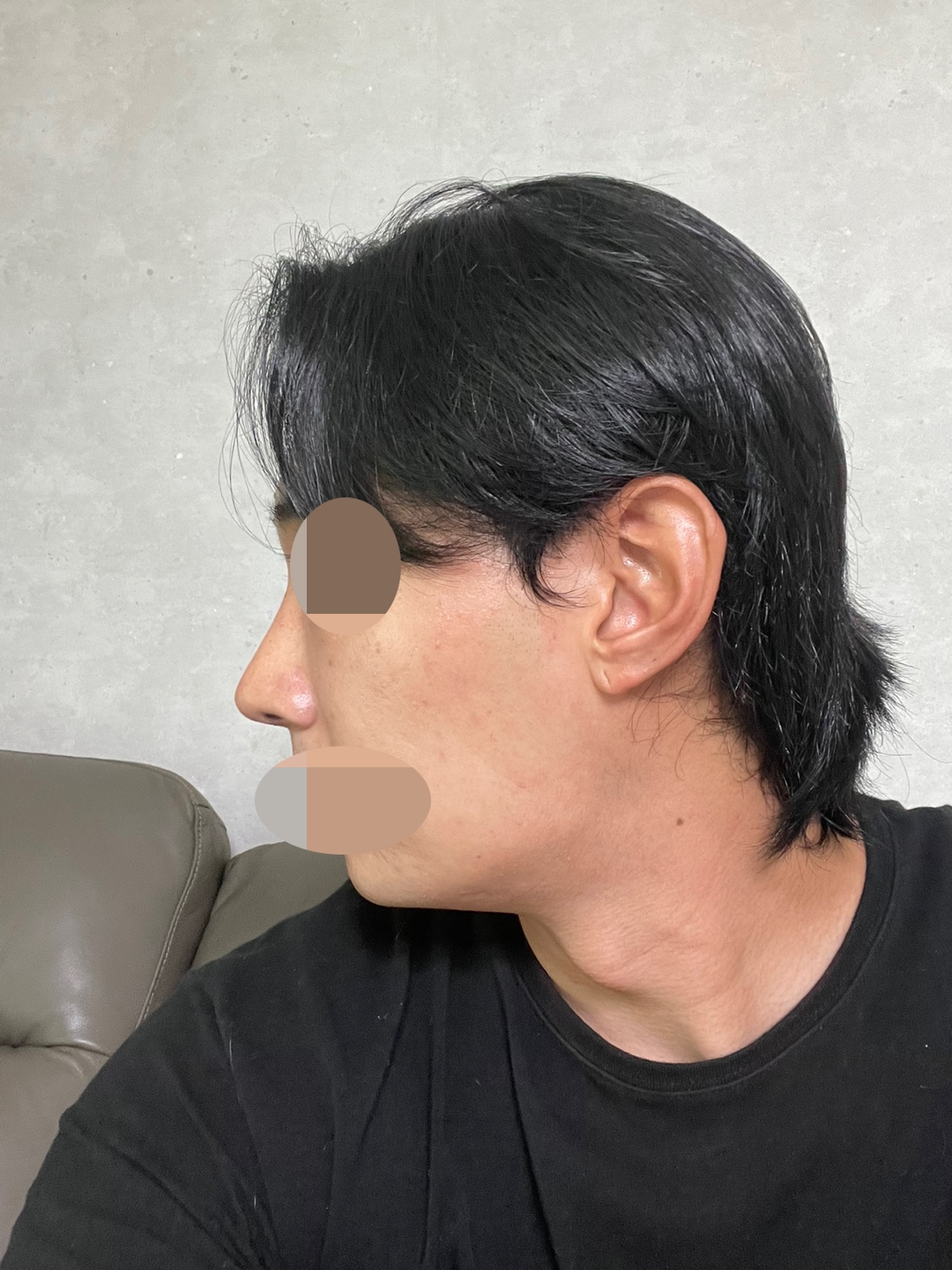 수술후기이미지