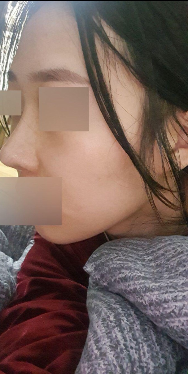 수술후기이미지