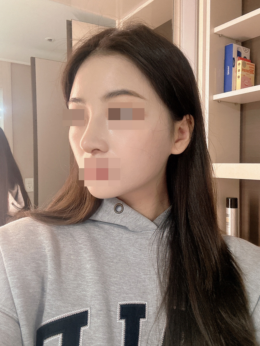 수술후기이미지