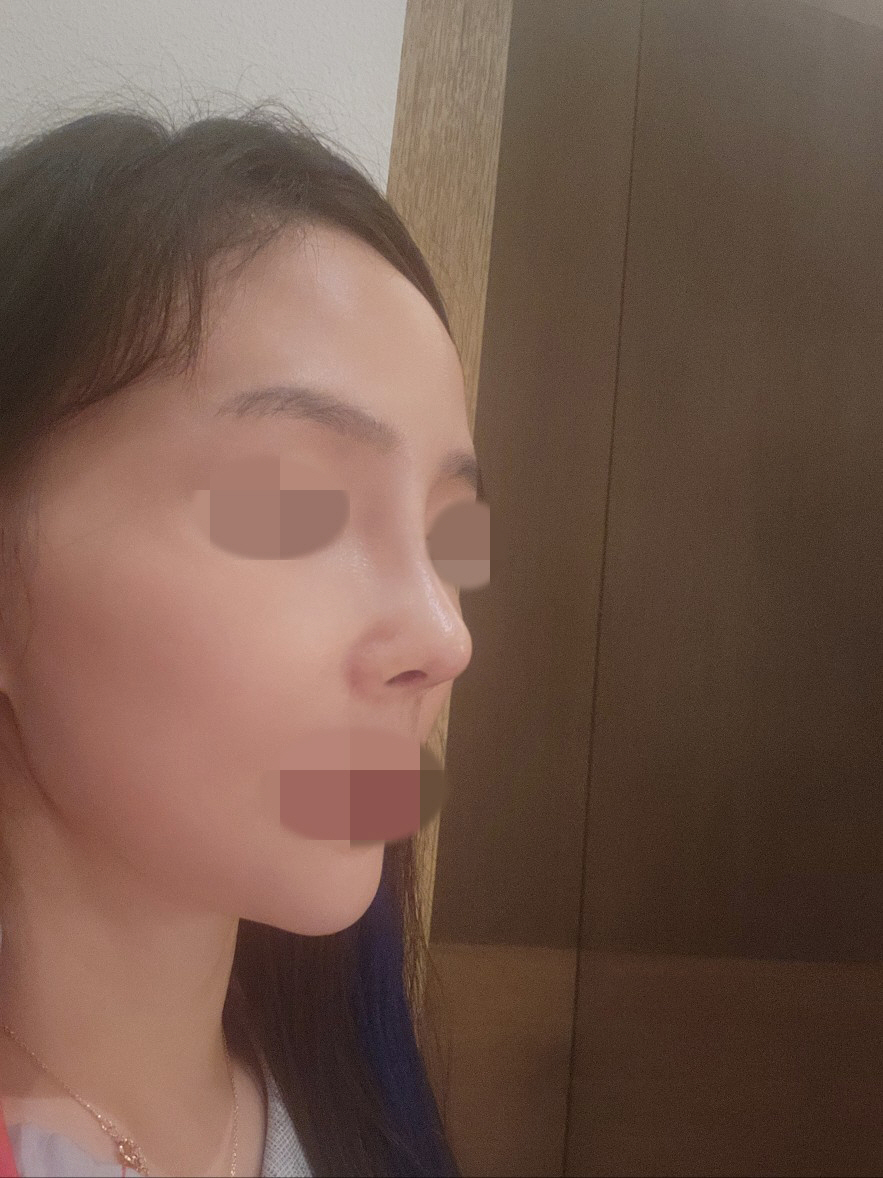 수술후기이미지