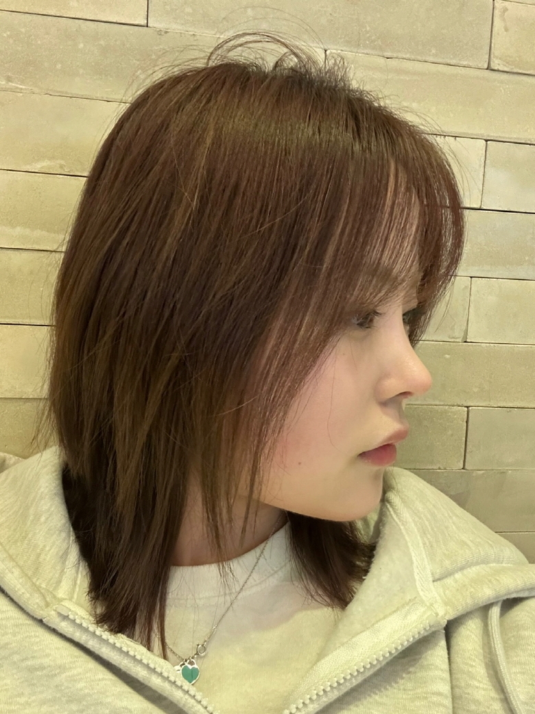 수술후기이미지