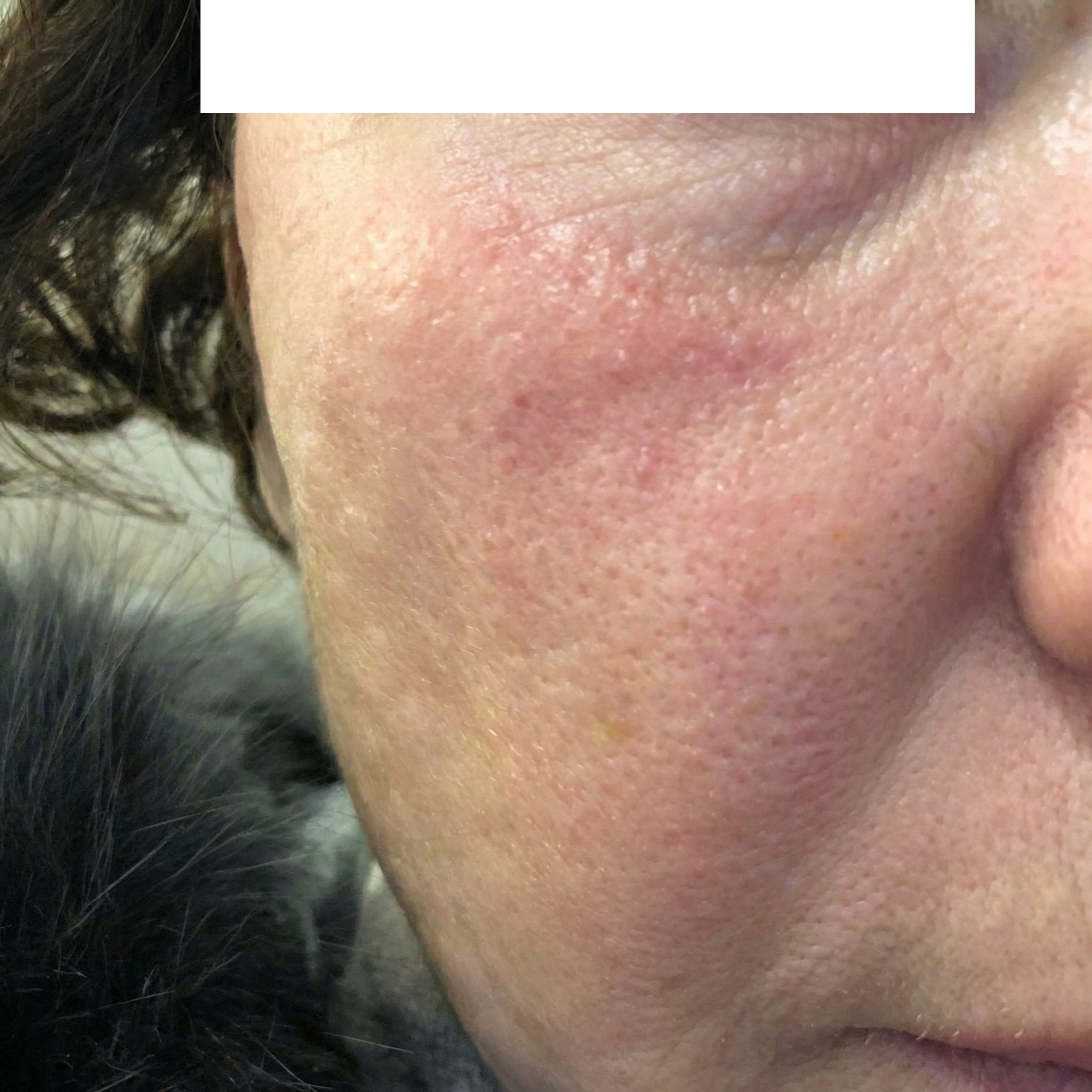 수술후기이미지