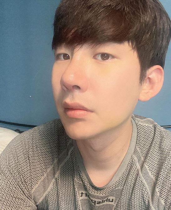 수술후기이미지