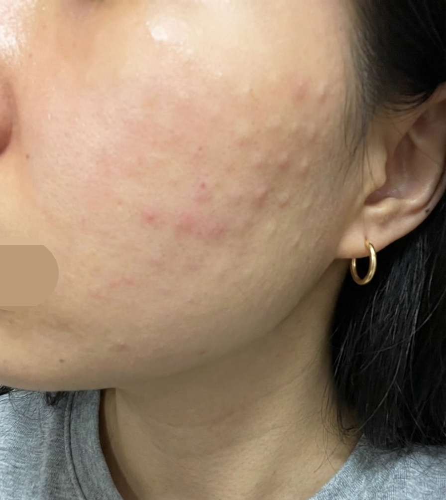 수술후기이미지