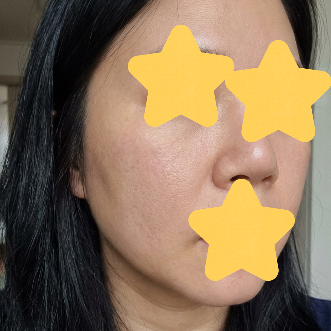 수술후기이미지