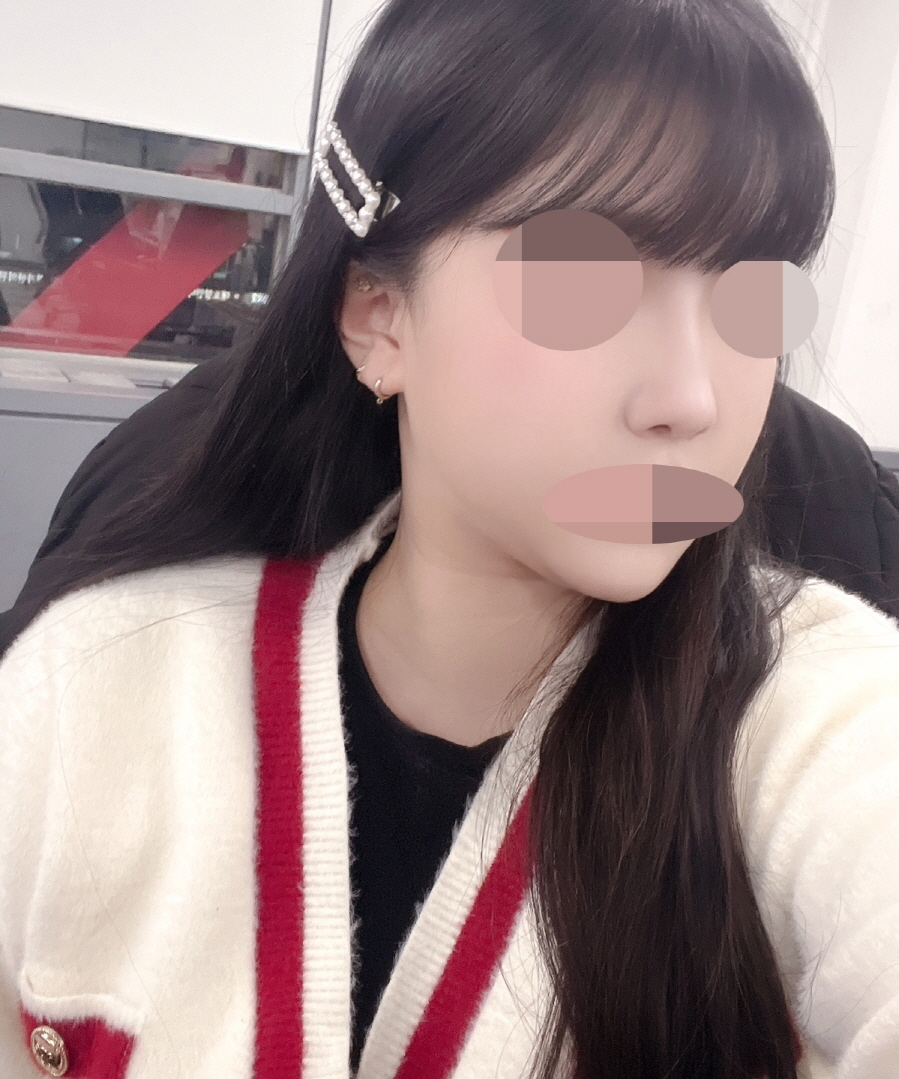 수술후기이미지