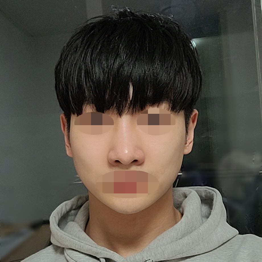 수술후기이미지