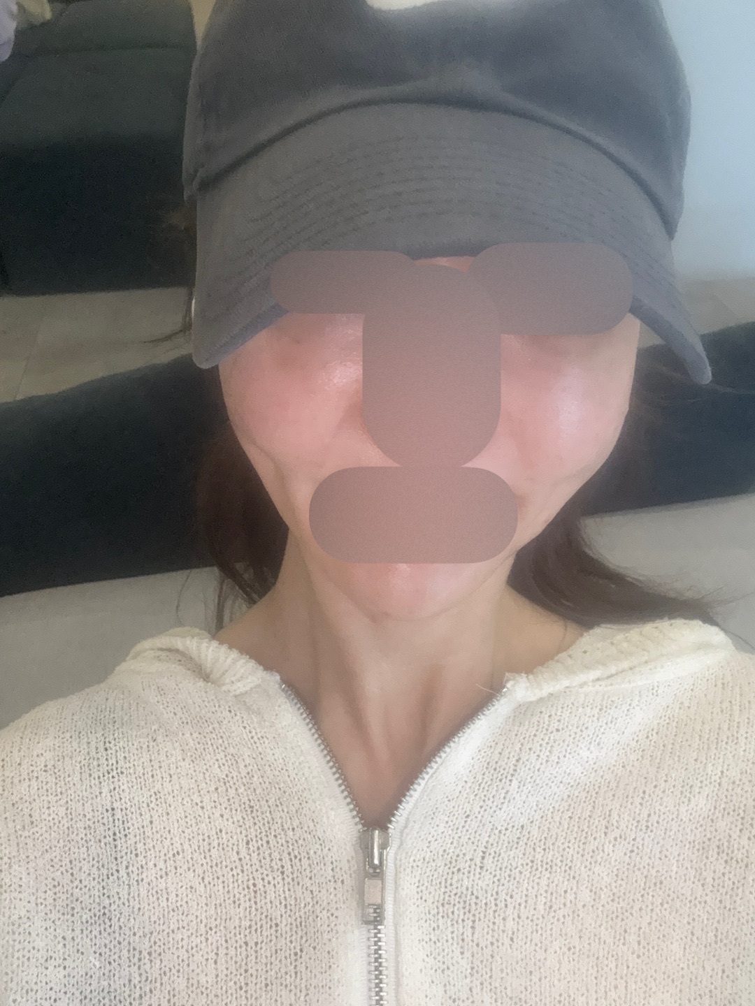 수술후기이미지