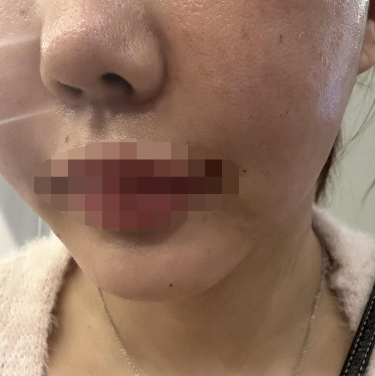 수술후기이미지